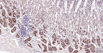 PI3-kinase p110 subunit beta Recombinant Rabbit Monoclonal Antibody