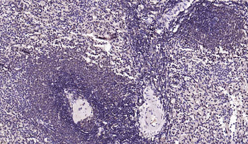 PI3-kinase p110 subunit beta Recombinant Rabbit Monoclonal Antibody
