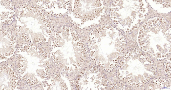 PIK3R2 Recombinant Rabbit Monoclonal Antibody