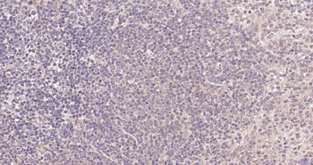 PIK3R2 Recombinant Rabbit Monoclonal Antibody