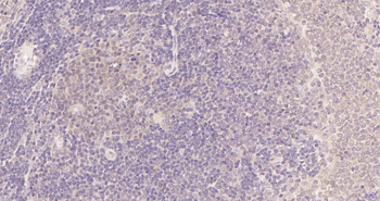 PIK3R2 Recombinant Rabbit Monoclonal Antibody