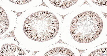 PIK3R2 Recombinant Rabbit Monoclonal Antibody