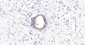 Phospho-YAP1 (Ser127) Recombinant Rabbit Monoclonal Antibody