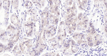 Phospho-YAP1 (Ser127) Recombinant Rabbit Monoclonal Antibody