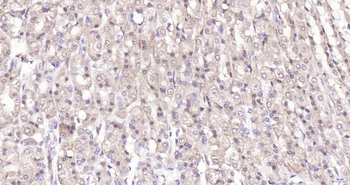 Phospho-YAP1 (Ser127) Recombinant Rabbit Monoclonal Antibody