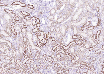 Phospho-TrkB (Tyr817) Recombinant Rabbit Monoclonal Antibody