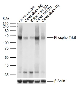 Phospho-TrkB (Tyr817) Recombinant Rabbit Monoclonal Antibody