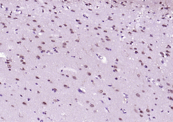 Phospho-STAT1 (Ser727) Recombinant Rabbit Monoclonal Antibody