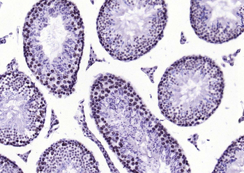 Phospho-STAT1 (Ser727) Recombinant Rabbit Monoclonal Antibody