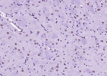 Phospho-STAT1 (Ser727) Recombinant Rabbit Monoclonal Antibody