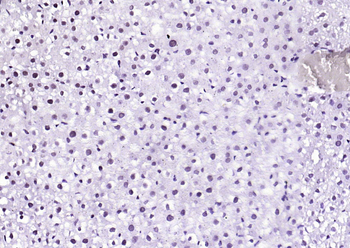 Phospho-STAT1 (Ser727) Recombinant Rabbit Monoclonal Antibody