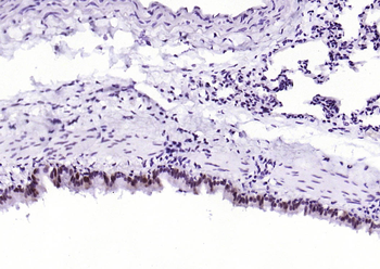 Phospho-STAT1 (Ser727) Recombinant Rabbit Monoclonal Antibody