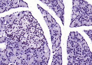 Phospho-STAT1 (Ser727) Recombinant Rabbit Monoclonal Antibody