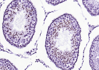 Phospho-STAT1 (Ser727) Recombinant Rabbit Monoclonal Antibody