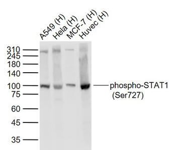 Phospho-STAT1 (Ser727) Recombinant Rabbit Monoclonal Antibody