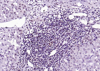 Phospho-STAT1 (Ser727) Recombinant Rabbit Monoclonal Antibody