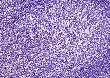 Phospho-STAT1 (Ser727) Recombinant Rabbit Monoclonal Antibody