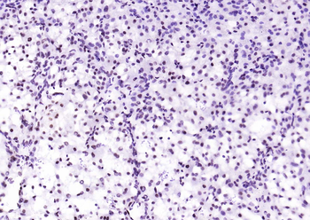 Phospho-STAT1 (Ser727) Recombinant Rabbit Monoclonal Antibody