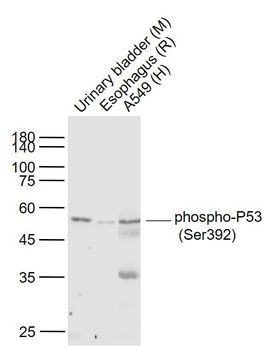 Phospho-P53 (Ser392) Recombinant Rabbit Monoclonal Antibody