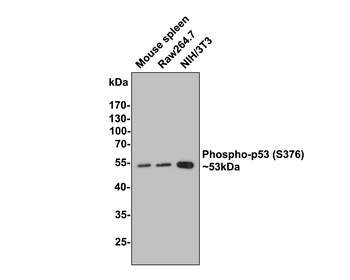 Phospho-P53 (Ser376) Recombinant Rabbit Monoclonal Antibody
