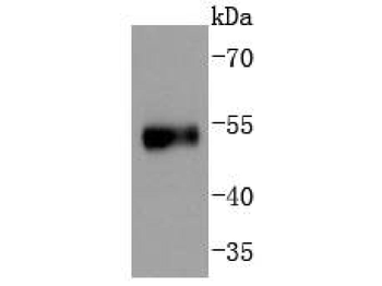 Phospho-P53 (Ser376) Recombinant Rabbit Monoclonal Antibody