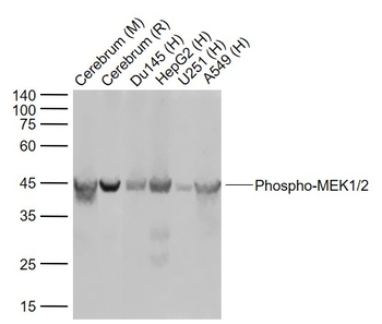 Phospho-MEK1/2 (Ser218 + Ser222) Recombinant Rabbit Monoclonal Antibody