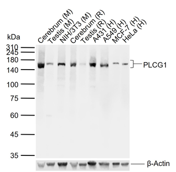 PLCG1 Recombinant Rabbit Monoclonal Antibody