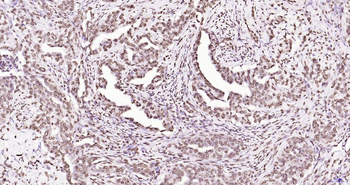 Phospho-JAK2 (Tyr1007+Tyr1008) Recombinant Rabbit Monoclonal Antibody