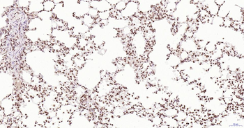 Phospho-JAK2 (Tyr1007+Tyr1008) Recombinant Rabbit Monoclonal Antibody