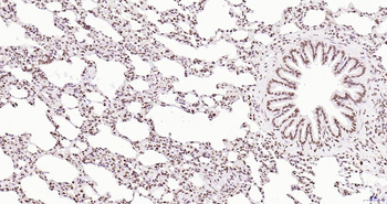 Phospho-JAK2 (Tyr1007+Tyr1008) Recombinant Rabbit Monoclonal Antibody