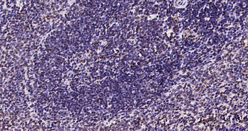 Phospho-JAK2 (Tyr1007+Tyr1008) Recombinant Rabbit Monoclonal Antibody