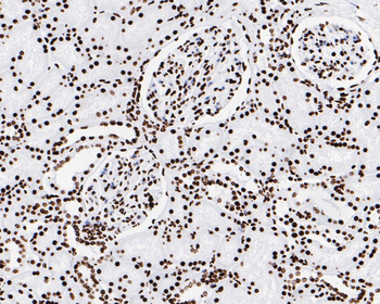 Phospho-JAK2 (Tyr1007+Tyr1008) Recombinant Rabbit Monoclonal Antibody