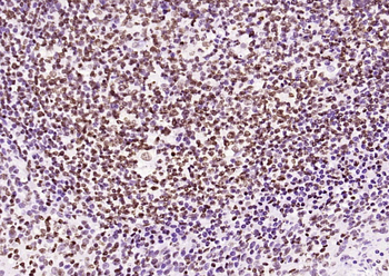 Phospho-JAK2 (Tyr1007+Tyr1008) Recombinant Rabbit Monoclonal Antibody