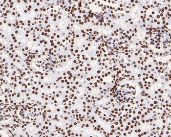 Phospho-JAK2 (Tyr1007+Tyr1008) Recombinant Rabbit Monoclonal Antibody