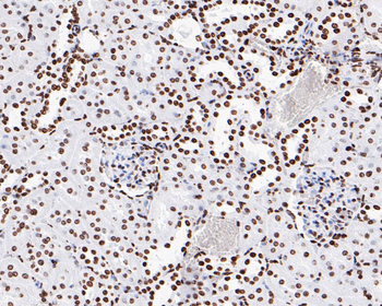 Phospho-JAK2 (Tyr1007+Tyr1008) Recombinant Rabbit Monoclonal Antibody
