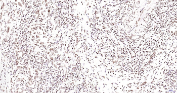 Phospho-JAK2 (Tyr1007+Tyr1008) Recombinant Rabbit Monoclonal Antibody