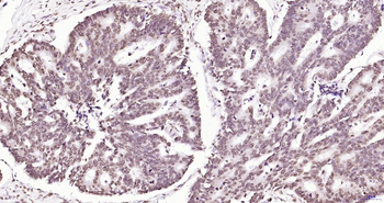 Phospho-JAK2 (Tyr1007+Tyr1008) Recombinant Rabbit Monoclonal Antibody
