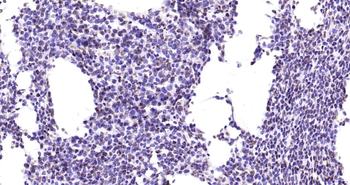 Phospho-JAK2 (Tyr1007+Tyr1008) Recombinant Rabbit Monoclonal Antibody