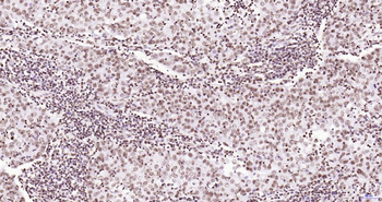 Phospho-JAK2 (Tyr1007+Tyr1008) Recombinant Rabbit Monoclonal Antibody