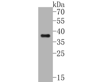 Phospho-IKB alpha (Ser32) Recombinant Rabbit Monoclonal Antibody