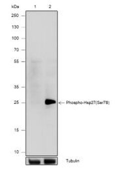 Phospho-HSP27 (Ser78) Recombinant Rabbit Monoclonal Antibody