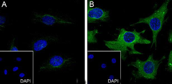 Phospho-HSP27 (Ser78) Recombinant Rabbit Monoclonal Antibody
