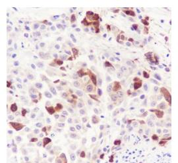 Phospho-HSP27 (Ser78) Recombinant Rabbit Monoclonal Antibody