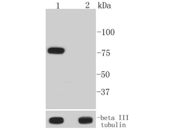 Phospho-BTK (Tyr223) Recombinant Rabbit Monoclonal Antibody