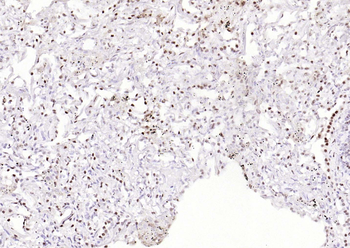 Phospho-ATF2 (Thr71) Recombinant Rabbit Monoclonal Antibody