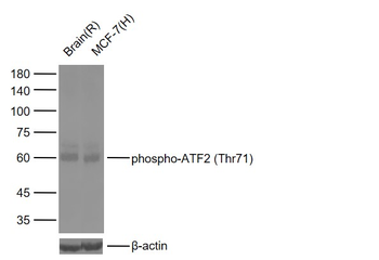 Phospho-ATF2 (Thr71) Recombinant Rabbit Monoclonal Antibody