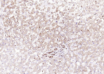 Phospho-ATF2 (Thr71) Recombinant Rabbit Monoclonal Antibody