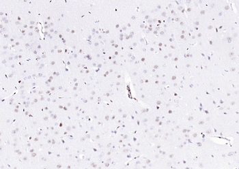 Phospho-ATF2 (Thr71) Recombinant Rabbit Monoclonal Antibody