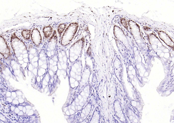 Phospho-ATF2 (Thr71) Recombinant Rabbit Monoclonal Antibody