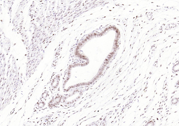 Phospho-ATF2 (Thr71) Recombinant Rabbit Monoclonal Antibody